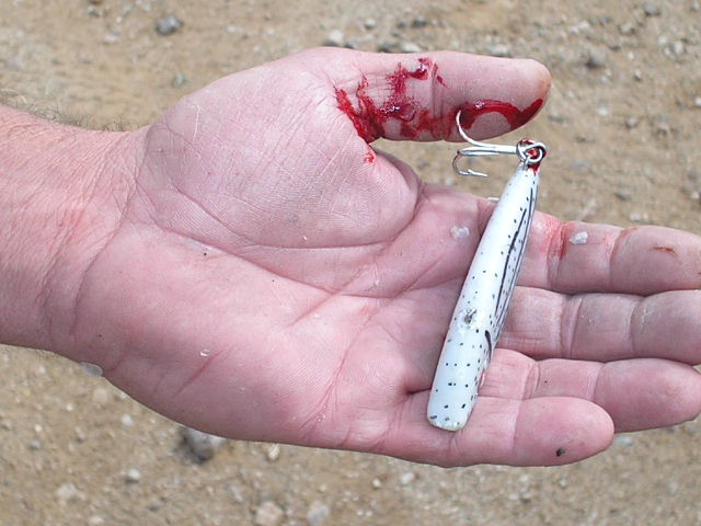 bleeding fish hook wound