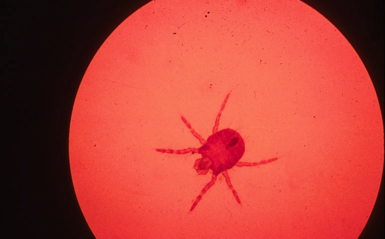 A magnified view of a biting chigger.