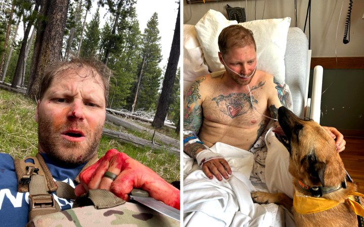 Grizzly bear attack victim in the woods and in the hospital.