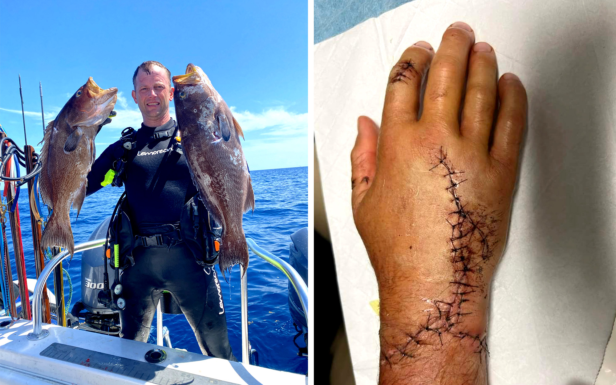 Spearfisherman Attacked by Bull Shark Says It’s a ‘Blessing’ He Kept His Hand